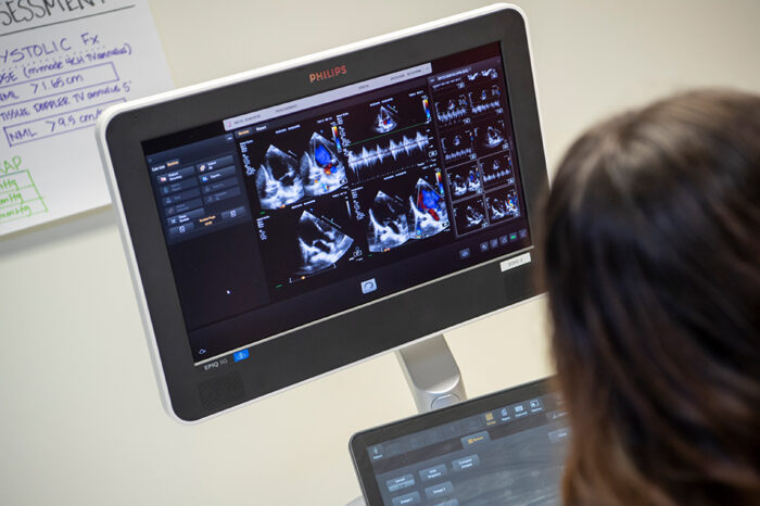 University of Findlay Alumna Hannah Hoehne Named Ultrasound Ambassador at Tallahassee Memorial Healthcare